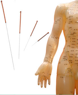 Acupuncture