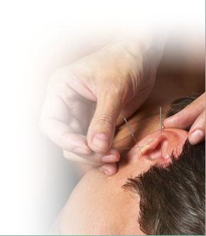 Auricular Acupuncture